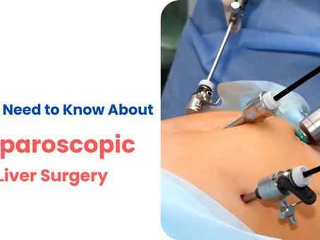 What is Laparoscopic Liver Surgery