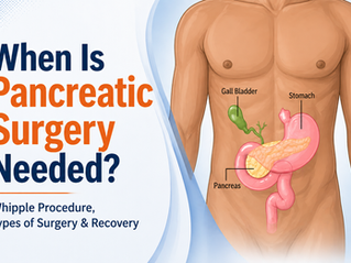 When Is Pancreatic Surgery Needed