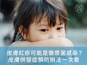皮膚紅疹可能是黴漿菌感染?皮膚併發症預防辦法一次看
