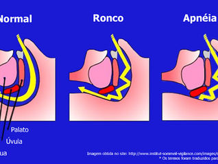 Ronco e Apneia 