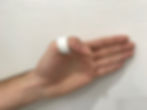 orthèse statique doigt type bague pour poulie A2