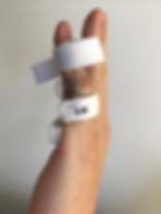 orthèse capener pour raideur IPP_edited