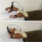 orthèse pour paralysie radiale