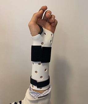 orthèse poignet fracture radius
