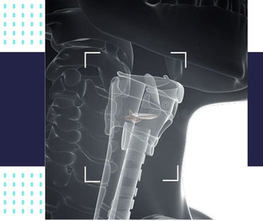 MALADIE DU PHARYNX ET DU LARYNX