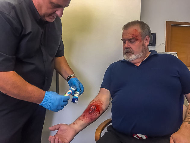 Open fracture and treatment (5).jpg