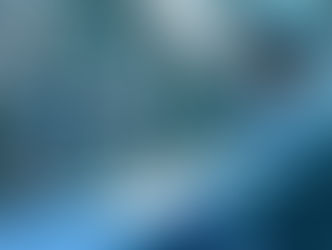 Surgical robotic assisting surgeon in a theatre