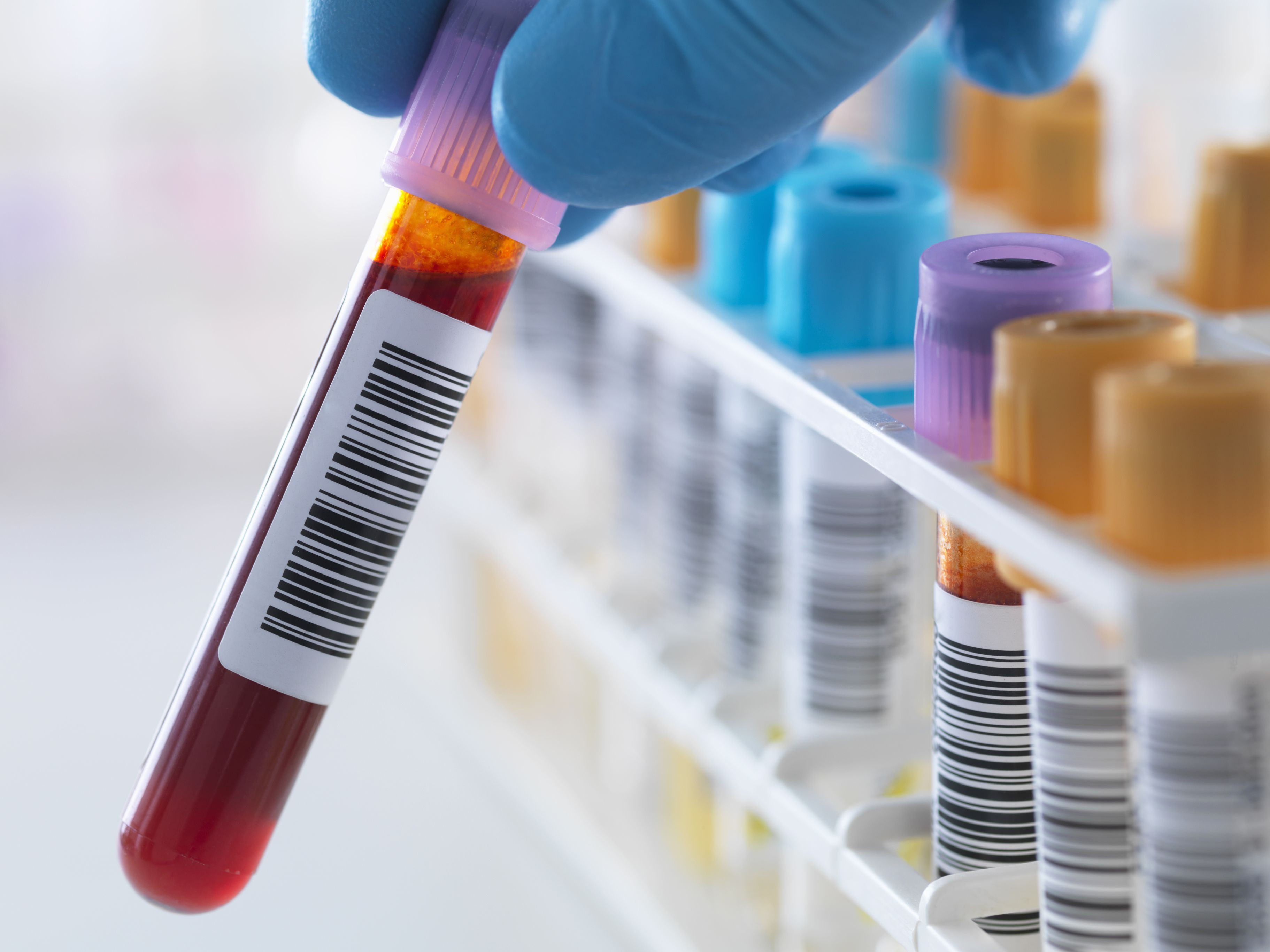 Specific Blood Tests The Spine Institute Murray, Utah