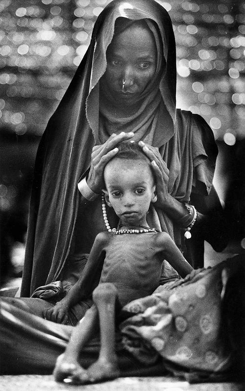 La fotografia ritrae una mamma con il suo bambino denutrito, bisognoso di cibo.