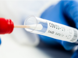 CORONAVIRUS: TAMPONI GRATUITI PER ALUNNI IN AUTOSORVEGLIANZA?