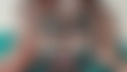 Understanding and Managing Proprioceptive Cervicogenic Dizziness (PCD) with Chiropractic Care