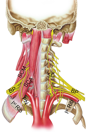 Figure 1: Diagrammatic representation of the thoracic outlet with the muscles included (Right) and without the muscles (left). BP = brachial plexus, SCA = scalenus anterior muscle, SCM = scalenus medium muscle, PN = phrenic nerve, SC = sympatheitc chain