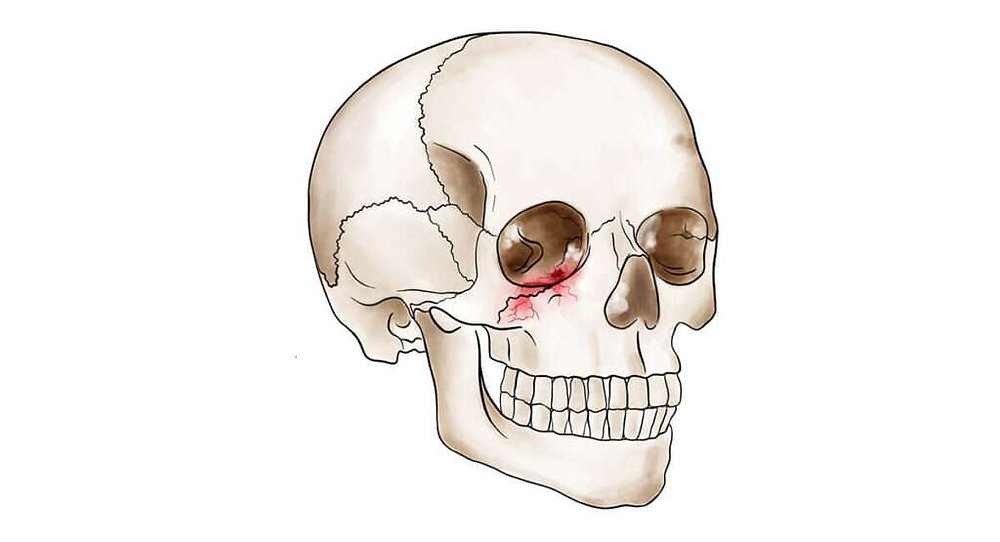 Facial Trauma Surgery Recovery Time Guide | Dr. Sireesha Rajesh