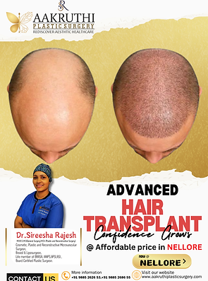 Advanced hair transplant centre in Nellore