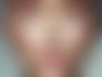 Rhinoplasty Surgery