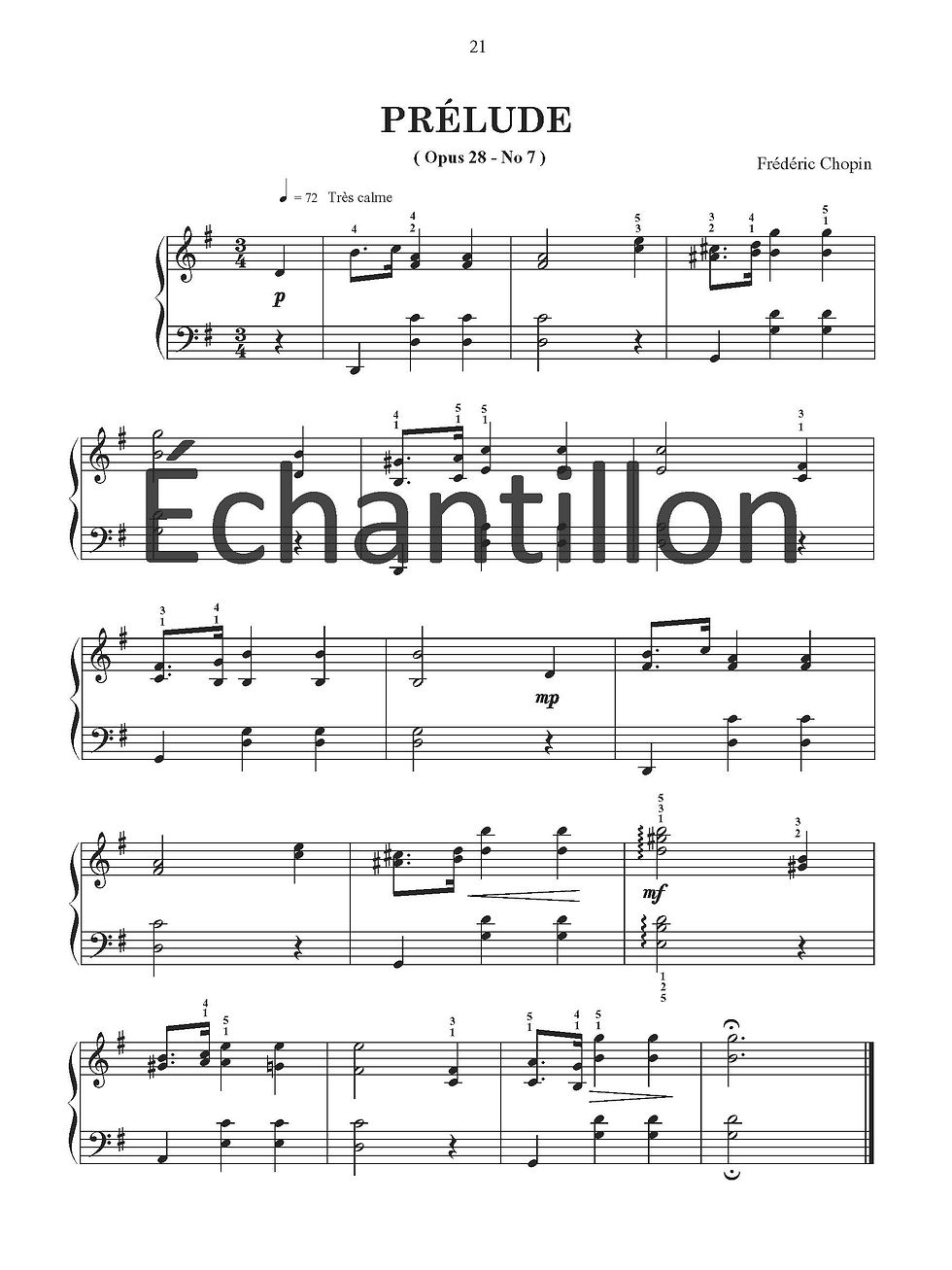 Miniature : Premier concert