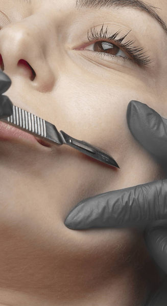 Dermaplaning in Naples, FL