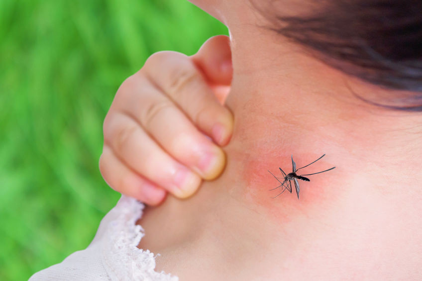 Piqures D Insectes Que Faire Pour Les Calmer
