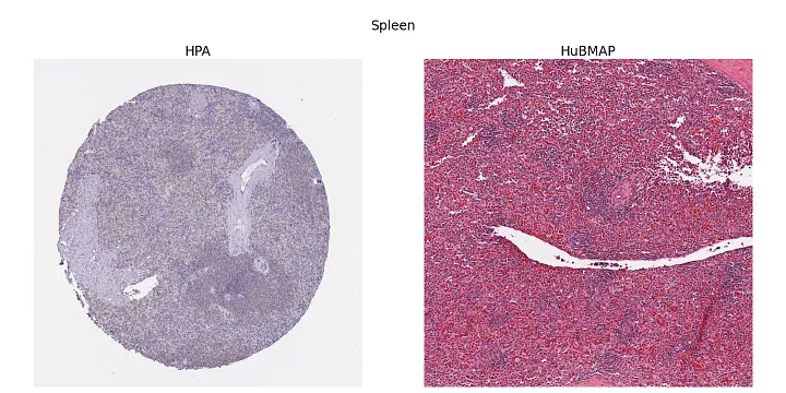 Left: spleen slice from HPA; right: spleen slice from HuBMAP