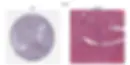 Left: spleen slice from HPA; right: spleen slice from HuBMAP