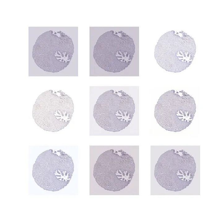 9 examples of the Vahadane stain augmentations of the same image