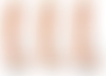 בצקות בזמן בהריון