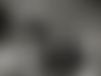 A mental health condition...