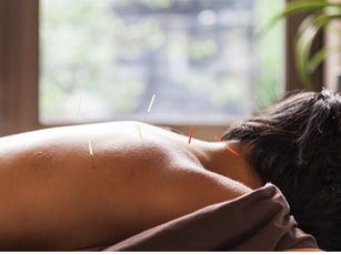 Balanced and Empowered: Acupuncture for Women's Wellness with Master Acupuncturist, Brian Kelly