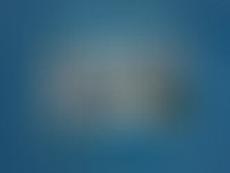 Utilizzare le 5M geriatriche per gestire la perdita di peso involontaria