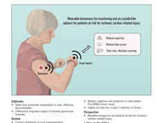 Sindrome metabolica collegata a un rischio di mortalità più elevato nel cancro al seno