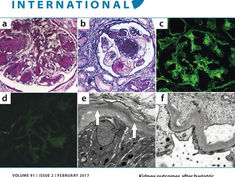 Troppo poco potassio nella dieta, meno IGF-1 nei muscoli