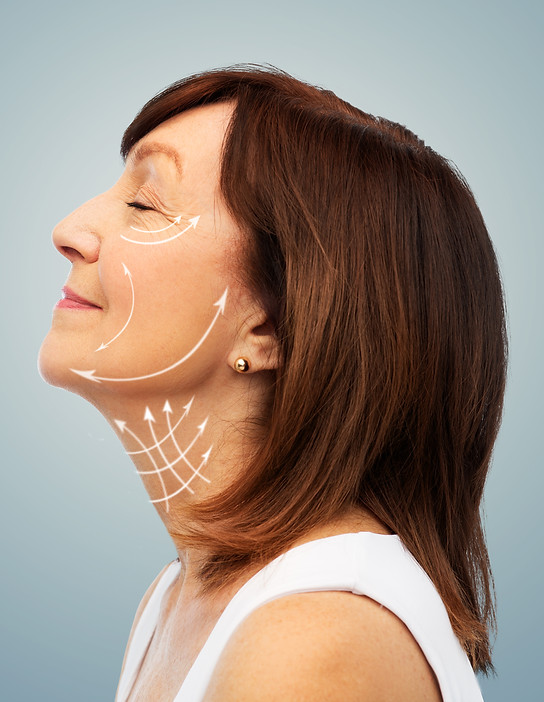 profile-senior-woman-with-face-lifting-arrows.jpg