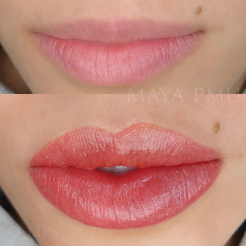 Q-Lips blushing Before and after