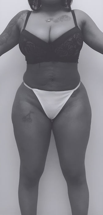 patient's body after BBL surgery in charlotte