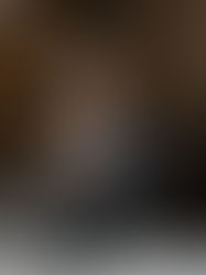 Oftalmologista analisa imagens oculares em monitor de alta resolução, representando a integração de diferentes exames — como OCT, retinografia, angiografia e ultrassonografia — utilizada na avaliação multimodal para diagnóstico preciso e seguro em oncologia ocular.