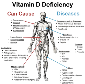 What can Vitamin D Deficiency lead too.