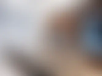 Modern dental clinic interior in Kyrenia, Northern Cyprus showing patient consultation with advanced digital imaging equipment — representing high-quality full-arch implant dentistry available in this dental tourism destination.