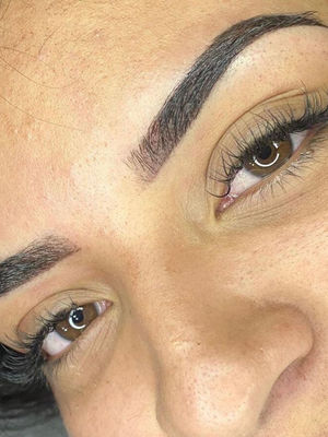 Alternative Laser Health’s Microblading results feature bold, healed brows with clean lines and natural pigment tone. This image reflects expert craftsmanship from certified brow artists in Mississauga, ensuring long-lasting, natural definition.