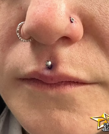 Medusa Lip Piercing (Philtrum)