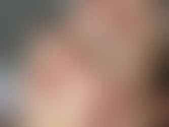 Microblading treatment recreating eyebrows for a client with alopecia at a Mississauga clinic