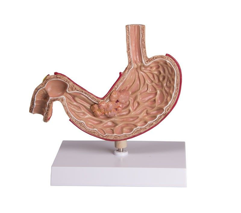 Miniatura: Medicazione / Gestione Peg