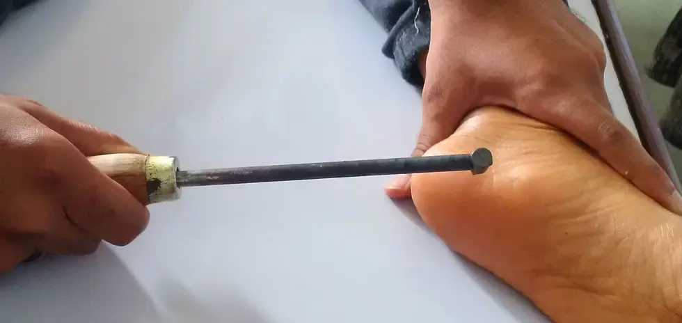 Foot therapy with pressure tool