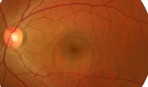 Design sem nome (79).png