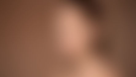 Photo of woman with healthy skin after skin booster and dermal filler treatments