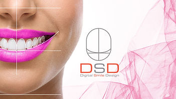 Digital Smile Design Dehradun Uttarakhand dentist