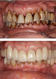 cosmetic Dentist Dehradun Uttarakhand