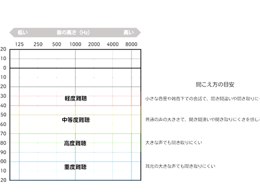聴力検査の見方