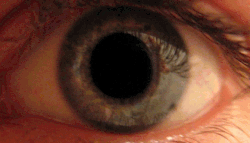 Eye_dilate.gif
