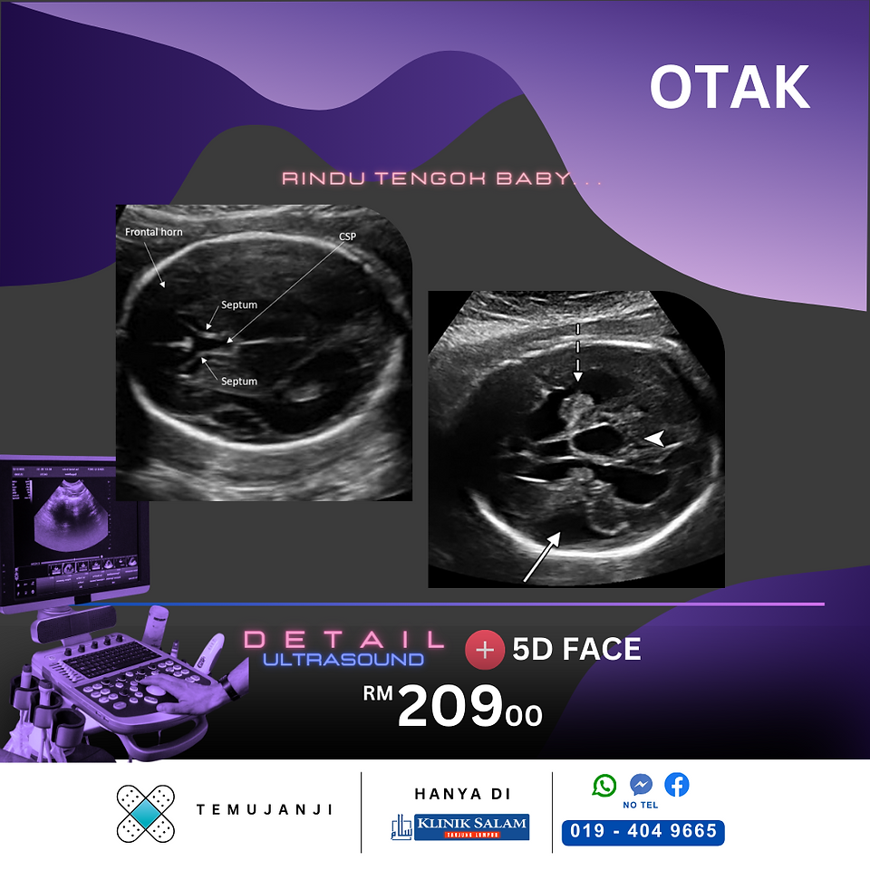 otak baby dalam kandungan