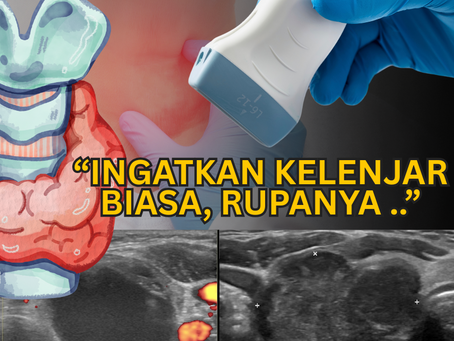 Ingatkan Ketulan Tiroid Biasa Saja? Hati-Hati, Ia Mungkin Kanser!